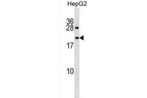 Western Blotting (WB) image for anti-Peptidylprolyl Isomerase A (Cyclophilin A)-Like 4A (PPIAL4A) antibody (ABIN3001342) (PPIAL4A anticorps)