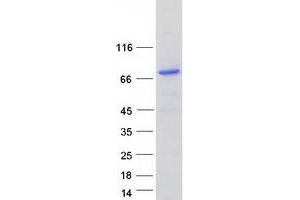Validation with Western Blot