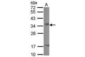 Image no. 1 for anti-Chromobox Homolog 7 (CBX7) (AA 19-224) antibody (ABIN1497121)