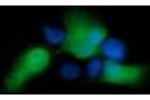 Image no. 7 for anti-Ubiquitin-Conjugating Enzyme E2G 2 (UBE2G2) antibody (ABIN1501631)