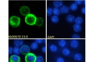 Immunofluorescence staining of fixed mouse splenocytes with anti-CD27 antibody LG. (Recombinant CD27 anticorps)