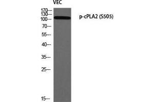 Western Blot (WB) analysis of VEC using p-cPLA2 (S505) antibody. (PLA2G4A anticorps  (pSer505))