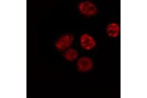 ABIN6267564 staining Hela by IF/ICC. (Histone H4 anticorps  (acLys5))