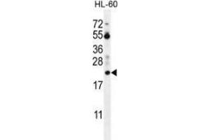 Western blot analysis in HL-60 cell line lysates (35ug/lane) using Prothymosin alpha Antibody (N-term). (PTMA anticorps  (N-Term))