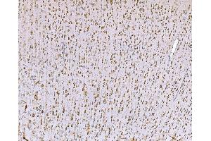 IHC analysis of SND1 using anti-SND1 antibody (ABIN7600526). (SND1 anticorps  (AA 20-204))