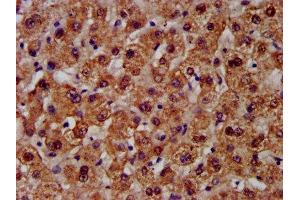 IHC image of ABIN7146668 diluted at 1:300 and staining in paraffin-embedded human liver tissue performed on a Leica BondTM system.