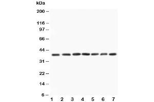 Western blot testing of MEK3 antibody and Lane 1:  rat skeletal muscle (MAP2K3 anticorps  (N-Term))