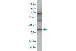 DSU monoclonal antibody (M01), clone 8F9-1B2 Western Blot analysis of DSU expression in MCF-7 ( Cat # L046V1 ).