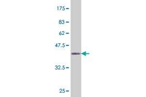 Western Blot detection against Immunogen (37.