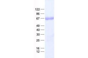 Validation with Western Blot