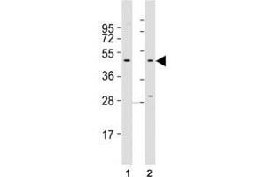 Western blot testing of CCR1 antibody at 1:2000 dilution.