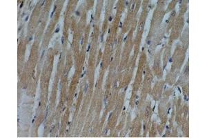 Rat heart tissue was stained by Anti-Adipo R1 (357-375) (Human) Antiserum