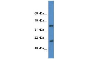 WB Suggested Anti-WBP5 Antibody Titration: 0. (WW Domain Binding Protein 5 (WBP5) (Middle Region) anticorps)
