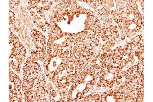 IHC-P Image Immunohistochemical analysis of paraffin-embedded NCI-N87 xenograft, using DECR1, antibody at 1:500 dilution.