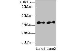 Western blot All lanes: SCAMP3 antibody at 2 μg/mL Lane 1: EC109 whole cell lysate Lane 2: 293T whole cell lysate Secondary Goat polyclonal to rabbit IgG at 1/15000 dilution Predicted band size: 39, 36 kDa Observed band size: 39 kDa (SCAMP3 anticorps  (AA 2-170))