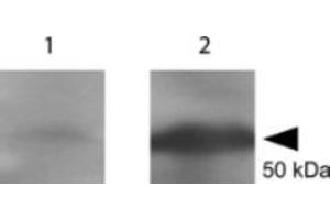 Western blot using  Anti-tetanus toxin C antibody shows detection of a protein band at 52 kDa corresponding to full length 6X HIS-TTFC fusion protein (arrowhead). (Tetanus Toxin C-Fragment (TTC) anticorps)