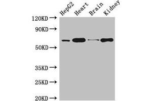 Western Blot Positive WB detected in: HepG2 whole cell lysate, Mouse heart tissue, Mouse brain tissue, Mouse kidney tissue All lanes: HNRNPL antibody at 3 μg/mL Secondary Goat polyclonal to rabbit IgG at 1/50000 dilution Predicted band size: 65, 51 kDa Observed band size: 65 kDa (HNRNPL anticorps  (AA 89-335))