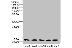 Western blot All lanes: TIMM10B antibody at 4 μg/mL Lane 1: Hela whole cell lysate Lane 2: 293T whole cell lysate Lane 3: HepG2 whole cell lysate Lane 4: K562 whole cell lysate Lane 5: Mouse heart tissue Secondary Goat polyclonal to rabbit IgG at 1/10000 dilution Predicted band size: 12 kDa Observed band size: 12 kDa (TIMM1B (AA 1-103) anticorps)