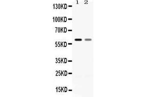 Western blot analysis of EAAT1 expression in rat brain extract ( Lane 1) and mouse brain extract ( Lane 2). (SLC1A3 anticorps  (N-Term))