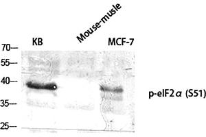 Western Blot analysis of KB (1), mouse-musle (2), MCF-7 (3), diluted at 1:2000. (EIF2A anticorps  (pSer51))