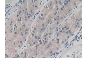 Detection of NGAL in Human Stomach Tissue using Monoclonal Antibody to Neutrophil gelatinase-associated lipocalin (NGAL) (Lipocalin 2 anticorps  (AA 21-198))