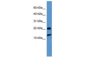 RPS27A antibody used at 0. (RPS27A anticorps  (Middle Region))