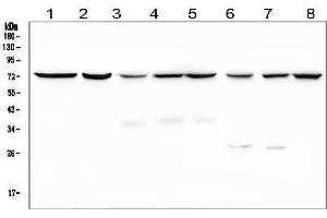 Western blot analysis of SLC5A2 using anti-SLC5A2 antibody (ABIN6719506).