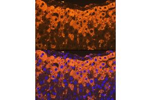 Immunofluorescence analysis of rat liver using Alpha-2-Macroglobulin (Alpha-2-Macroglobulin (M)) Rabbit mAb (ABIN7265558) at dilution of 1:100 (40x lens).