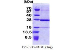 SDS-PAGE (SDS) image for Chromosome 19 Open Reading Frame 50 (C19orf50) (AA 1-176) protein (His tag) (ABIN6387263)