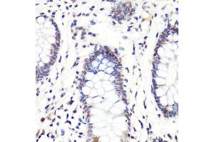Immunohistochemistry of paraffin-embedded human colon using H3R2me2a antibody. (Histone 3 anticorps  (H3R2me2))