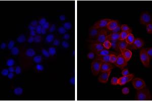 Human pancreatic carcinoma cell line MIA PaCa-2 was stained with Mouse Anti-Human CD44-UNLB, and DAPI.