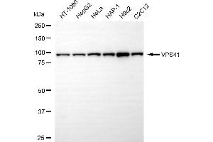 Western blotting analysis using VPS41 antibody (ABIN7800815). (Recombinant VPS41 anticorps)
