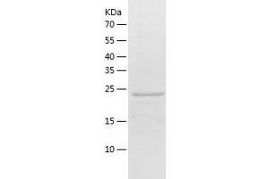 Western Blotting (WB) image for Egl-9 Family Hypoxia Inducible Factor 3 (EGLN3) (AA 1-239) protein (His-IF2DI Tag) (ABIN7122748)
