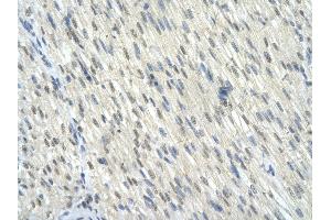 Rabbit Anti-KLF10 antibody        Paraffin Embedded Tissue:  Human Heart cell   Cellular Data:  Epithelial cells of renal tubule  Antibody Concentration:   4. (KLF10/TIEG1 anticorps  (C-Term))