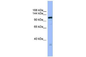 FAM29A antibody used at 1 ug/ml to detect target protein. (FAM29A anticorps  (Middle Region))