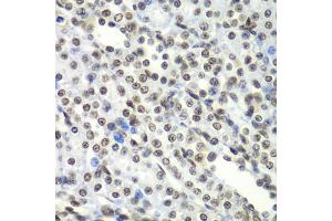 Immunohistochemistry of paraffin-embedded rat kidney using SF3B2 antibody (ABIN5973482) at dilution of 1/100 (40x lens). (SF3B2 anticorps)