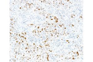 anti-Minichromosome Maintenance Complex Component 2 (MCM2) (pSer108) antibody