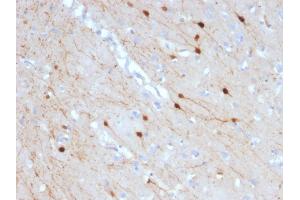 Formalin-fixed, paraffin-embedded human Cerebellum stained with Calretinin Mouse Monoclonal Antibody (CALB2/2685). (Calretinin anticorps  (AA 23-242))
