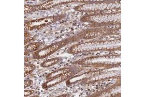 Immunohistochemical staining of human stomach with DDA1 polyclonal antibody  shows moderate cytoplasmic positivity in glandular cells at 1:50-1:200 dilution.