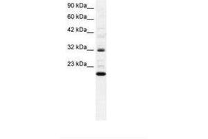Image no. 1 for anti-rho GDP Dissociation Inhibitor (GDI) gamma (ARHGDIG) (AA 42-90) antibody (ABIN6735819) (ARHGDIG anticorps  (AA 42-90))