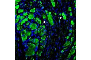 Expression of MRGD in rat DRGImmunohistochemical staining of rat dorsal root ganglion (DRG) sections using Anti-MRGPRD (GPCR TGR7) Antibody (ABIN7581915), (1:200), followed by goat-anti rabbit-AlexaFluor-488.