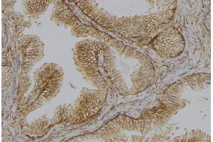 ABIN6278644 at 1/100 staining Mouse colon tissue by IHC-P. (TMPRSS3 anticorps  (Internal Region))