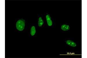Immunofluorescence of monoclonal antibody to NHLH2 on HeLa cell. (NHLH2 anticorps  (AA 36-135))