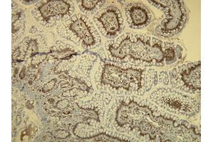 Immunohistochemistry (IHC) image for anti-B-Raf proto-oncogene, serine/threonine kinase (BRAF) antibody (ABIN7598779) (BRAF anticorps)