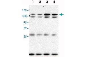 Immunoprecipitation and Western blot analysis in Lane 1: parental BaF3 cells, Lane 2: BaF3+BCR-ABL (BaF3 cells transduced with BCR-ABL), Lane 3: BaF3+BCR-ABL+mAhi-I (M1, BaF3 cells transduced with both BCR-ABL and mouse Ahi-1, M1 is a clonal cell line), Lane 4: BaF3+BCR-ABL+mAhi-1 (C2, BaF3 cells transduced with both BCR-ABL and mouse Ahi-1, C2 is a clonal cell line) with Ahi1 monoclonal antibody, clone 645s3 . (AHI1 anticorps  (C-Term))