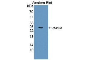 Detection of Recombinant SDHB, Mouse using Polyclonal Antibody to Succinate Dehydrogenase Complex Subunit B (SDHB) (SDHB anticorps  (AA 97-282))