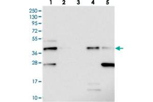 Western blot analysis of Lane 1: RT-4, Lane 2: U-251 MG, Lane 3: Human Plasma, Lane 4: Liver, Lane 5: Tonsil with C19orf66 polyclonal antibody  at 1:250-1:500 dilution. (C19ORF66 anticorps)