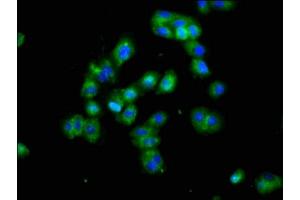 Immunofluorescence staining of HepG2 cells with ABIN7165254 at 1:100, counter-stained with DAPI. (DLK1 anticorps  (AA 24-303))