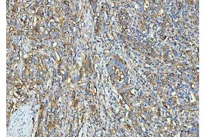 IHC analysis of ICAM1 using anti-ICAM1 antibody (ABIN7601066).