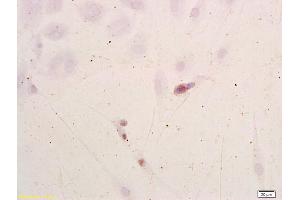 Neuroblastoma cells labeled with Anti-NSE/ENO2/? (ENO2/NSE anticorps  (AA 201-300))